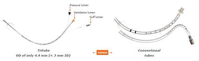 Evone® Flow-Controlled Ventilation During Upper Airway Surgery: A Clinical Feasibility Study and Safety Assessment